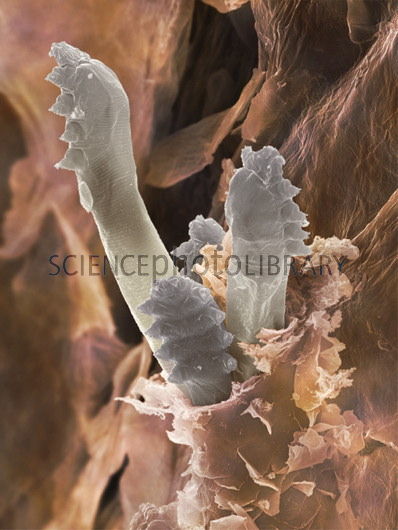 demodex parasites Whats that crawling out of your eyelids? Parasites? Arrrgh!