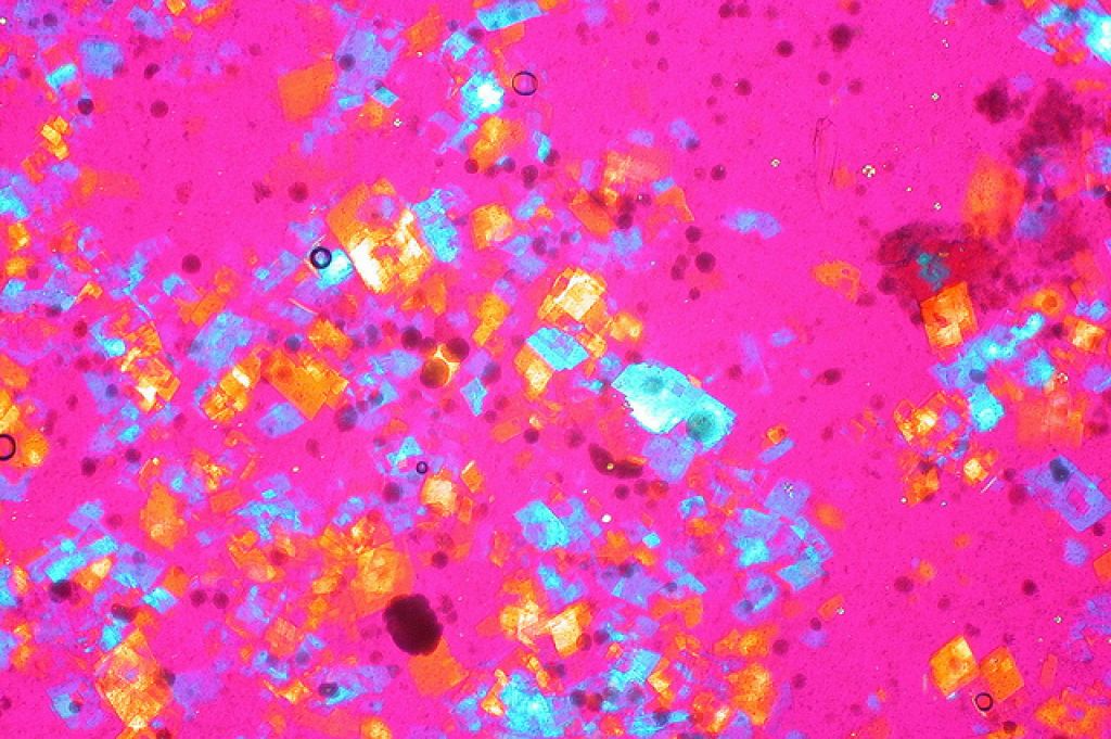 cholesterol1 Bad Cholesterol And Its Body Production and Effect on Health