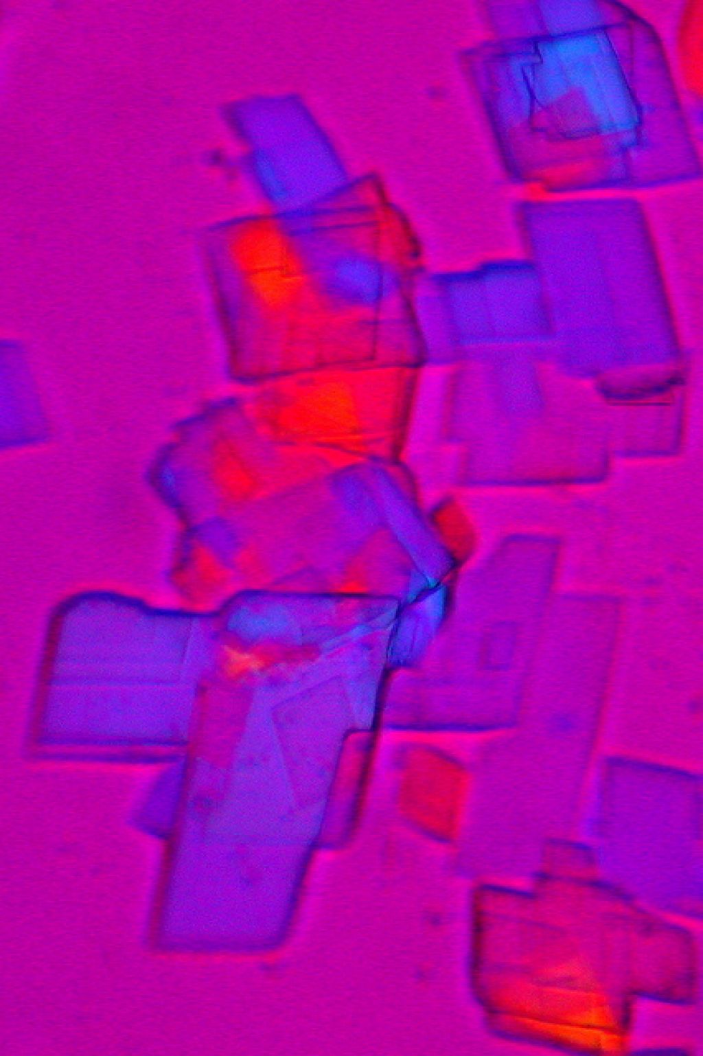 cholesterol2 Bad Cholesterol And Its Body Production and Effect on Health