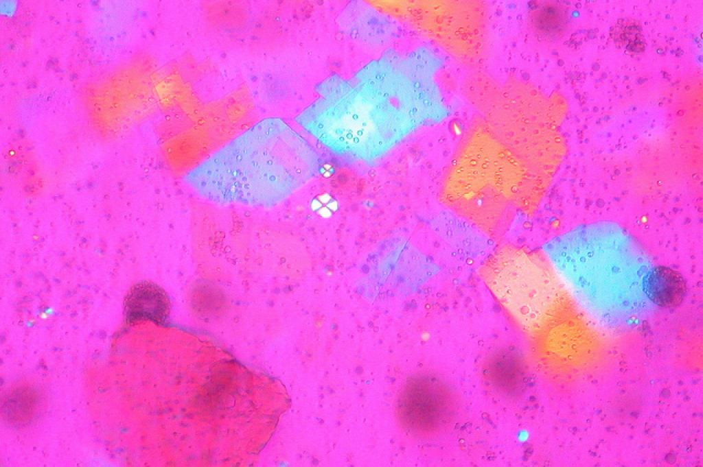 cholesterol4 Bad Cholesterol And Its Body Production and Effect on Health